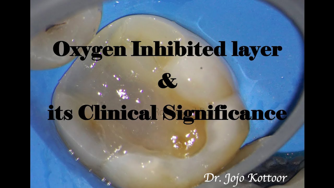 Oxygen Inhibited Layer & its Significance