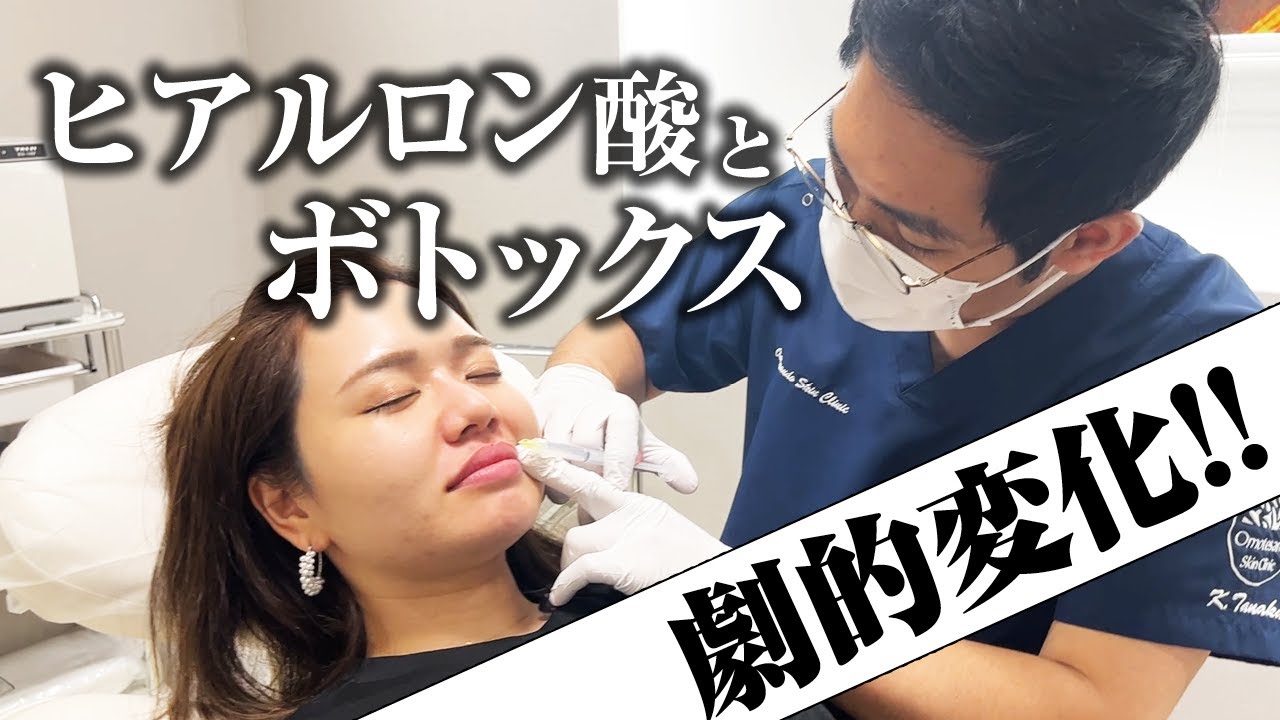 【施術動画】唇ヒアルロン酸＆口角・小鼻ボトックスを注入してみた【劇的変化】