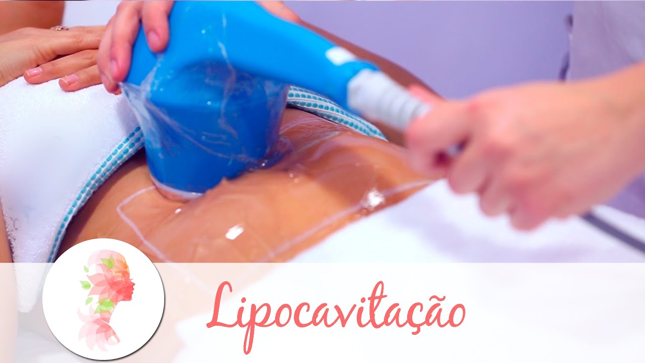 Lipocavitação: tratamento estético reduz gordura localizada