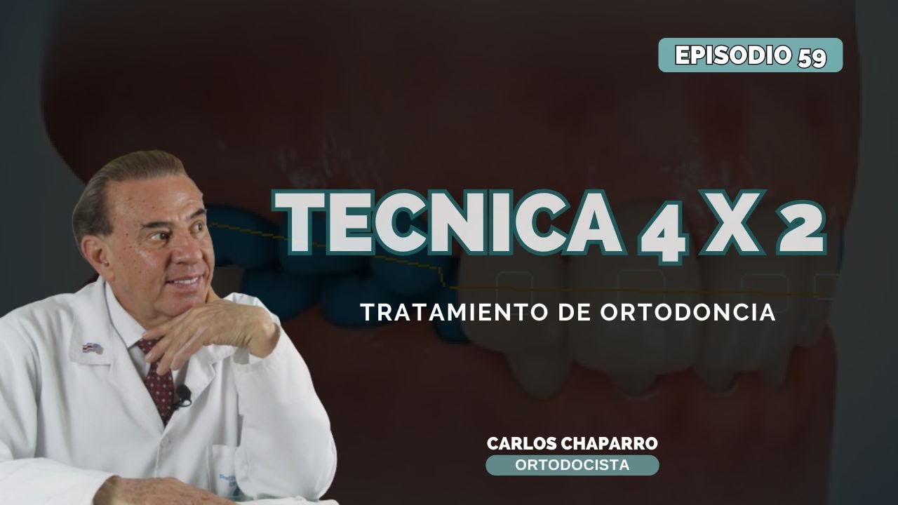 Técnica de tratamiento 4 x 2  - EPISODIO 59