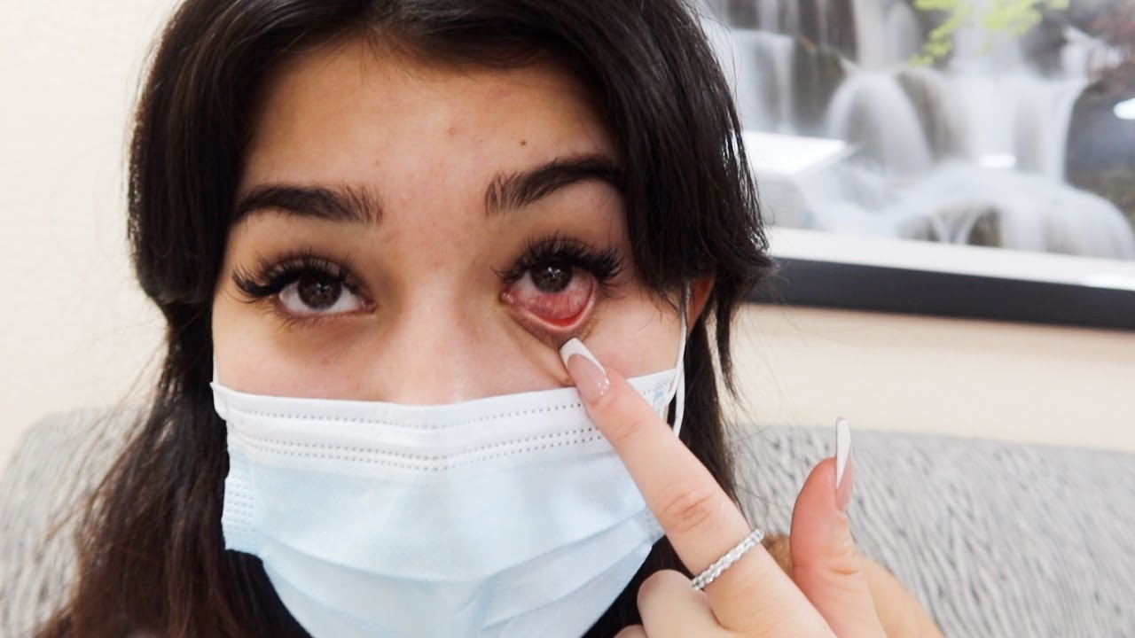 My Eyelash Extensions Did THIS To My Eye + Going on a cruise!