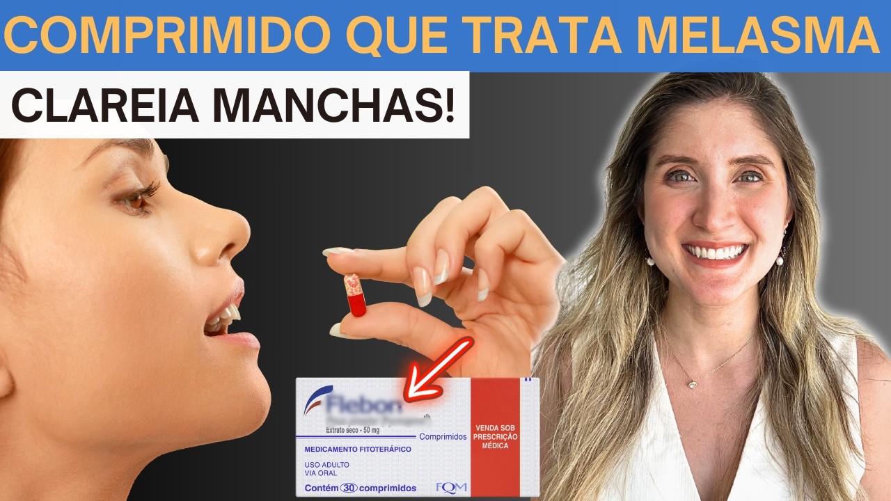 FLEBON para Melasma + Benefícios para a Pele- [Dermato Ensina Como Usar]