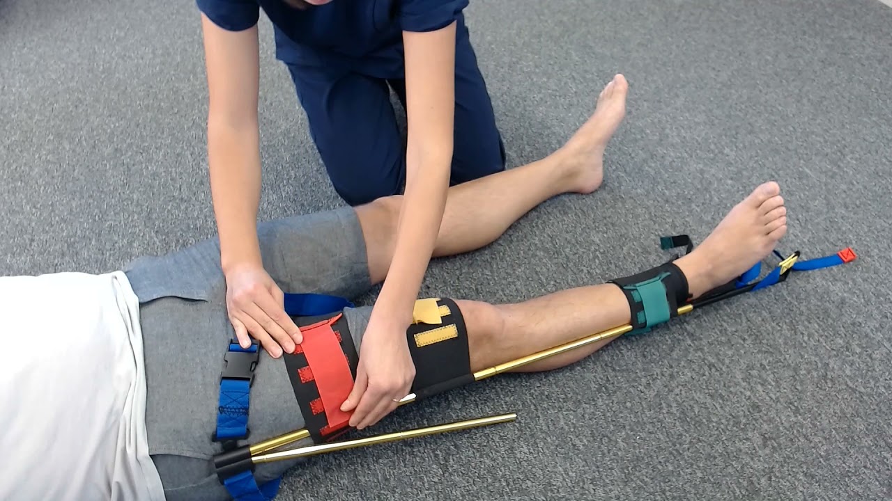 Traction Splint Application for use in Femur Fractures