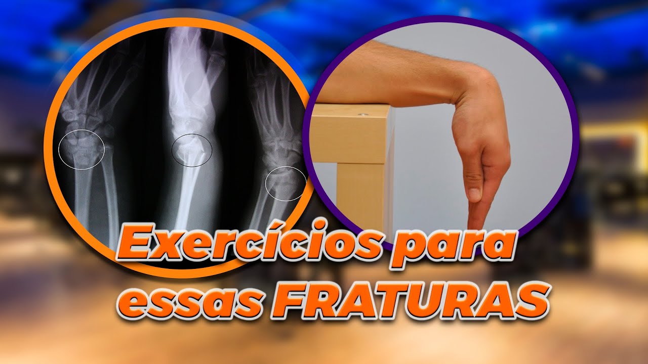 Exercício para fratura de Escafóide e fratura de colles