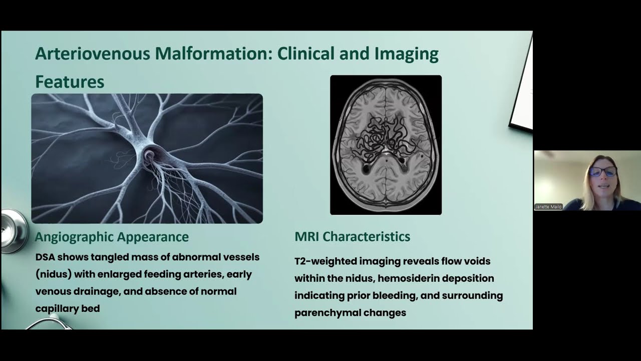 NSGR: Pediatric Intracerebral Hemorrhage Management, presented by Janette Mailo, MD on 2/16/26.