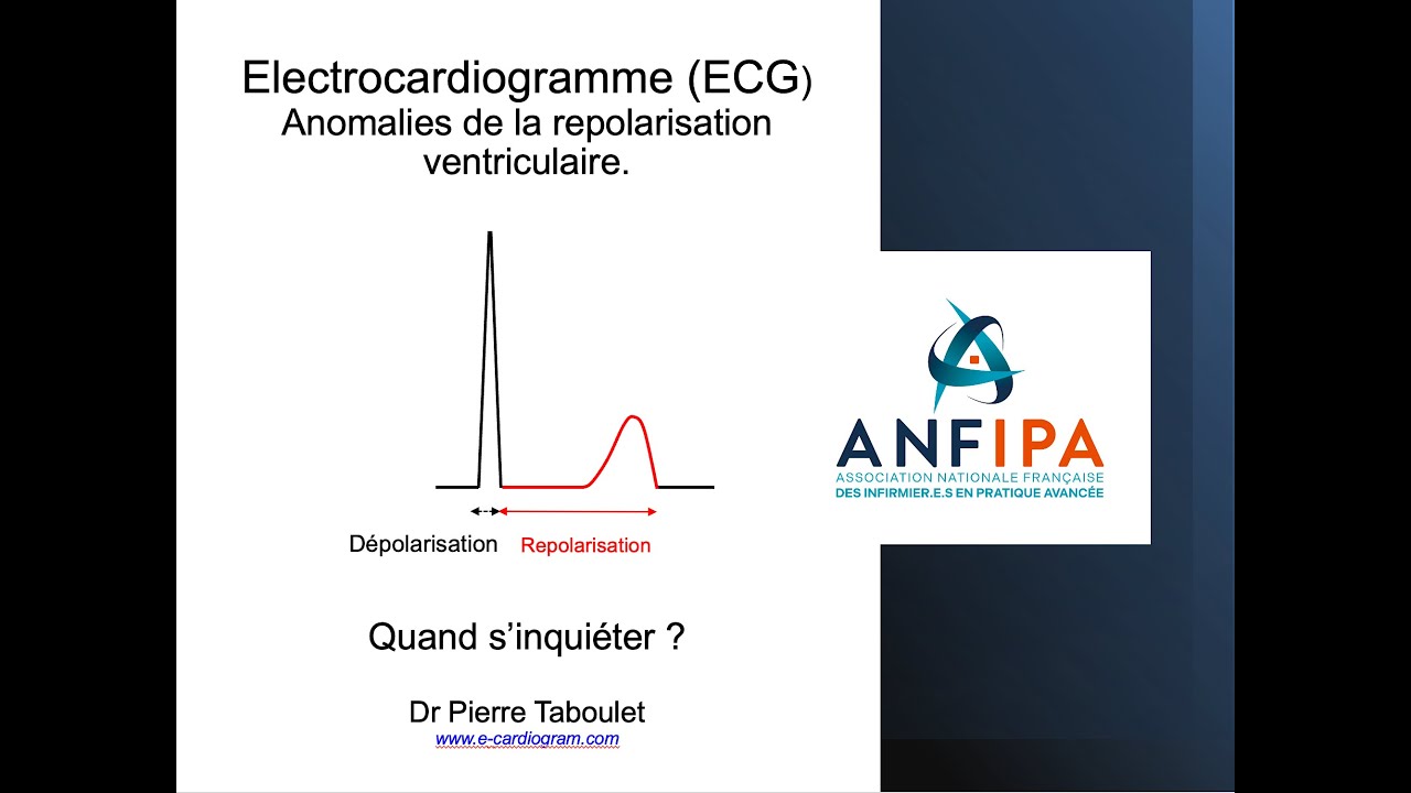 ECG. Anomalies de repolarisation. Quand s'inquiéter (infirmier.e) ?