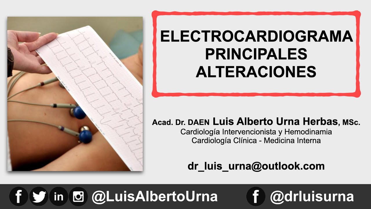 Electrocardiograma principales alteraciones