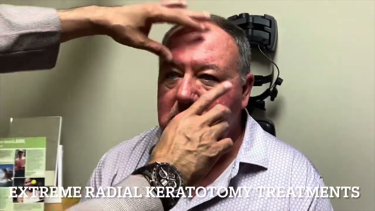 Extreme Radial Keratotomy Correction @GulaniVision 