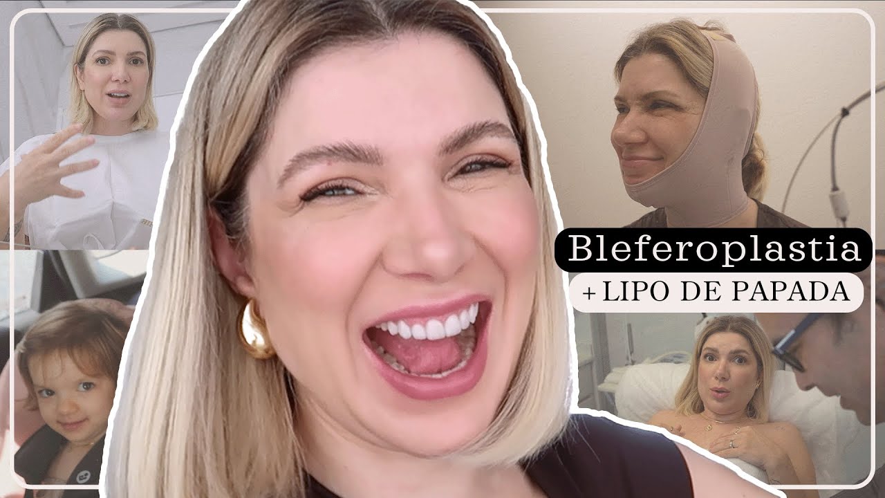 Vlog Fiz a Blefaroplastia + Lipo de Papada | Deusa Constanzi