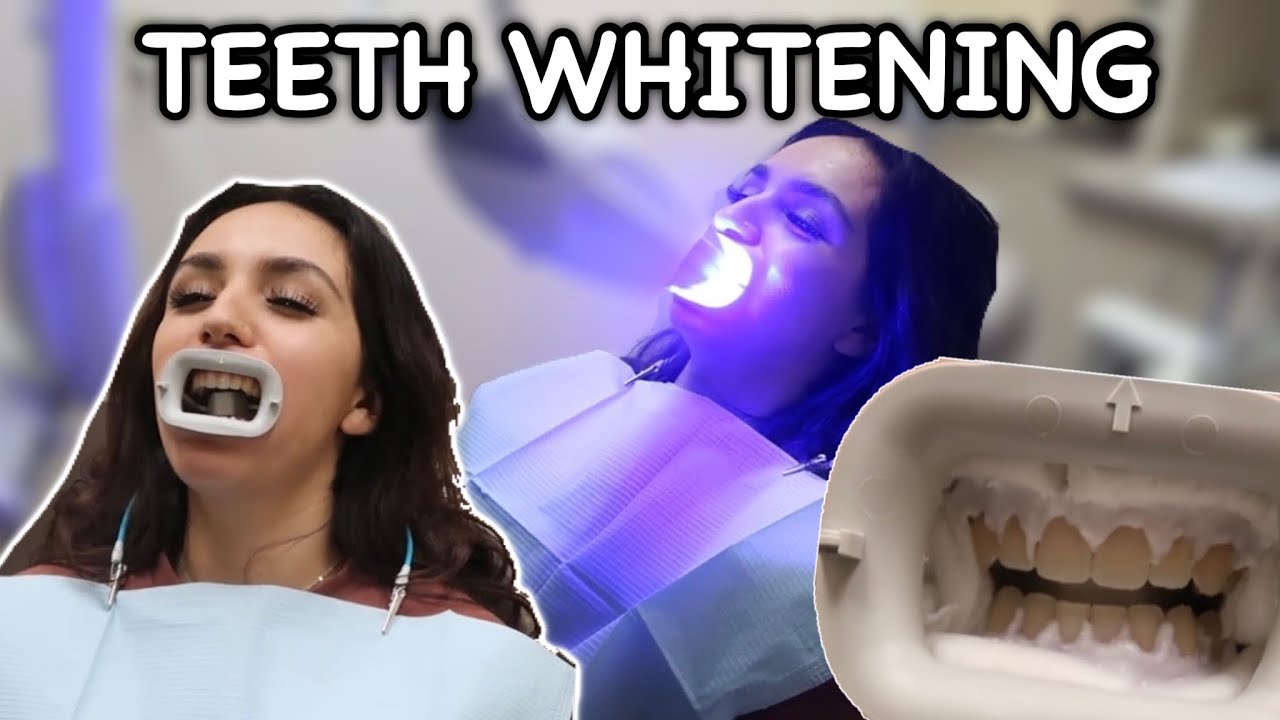 WATCH ME GET MY TEETH BLEACHED *VLOG*