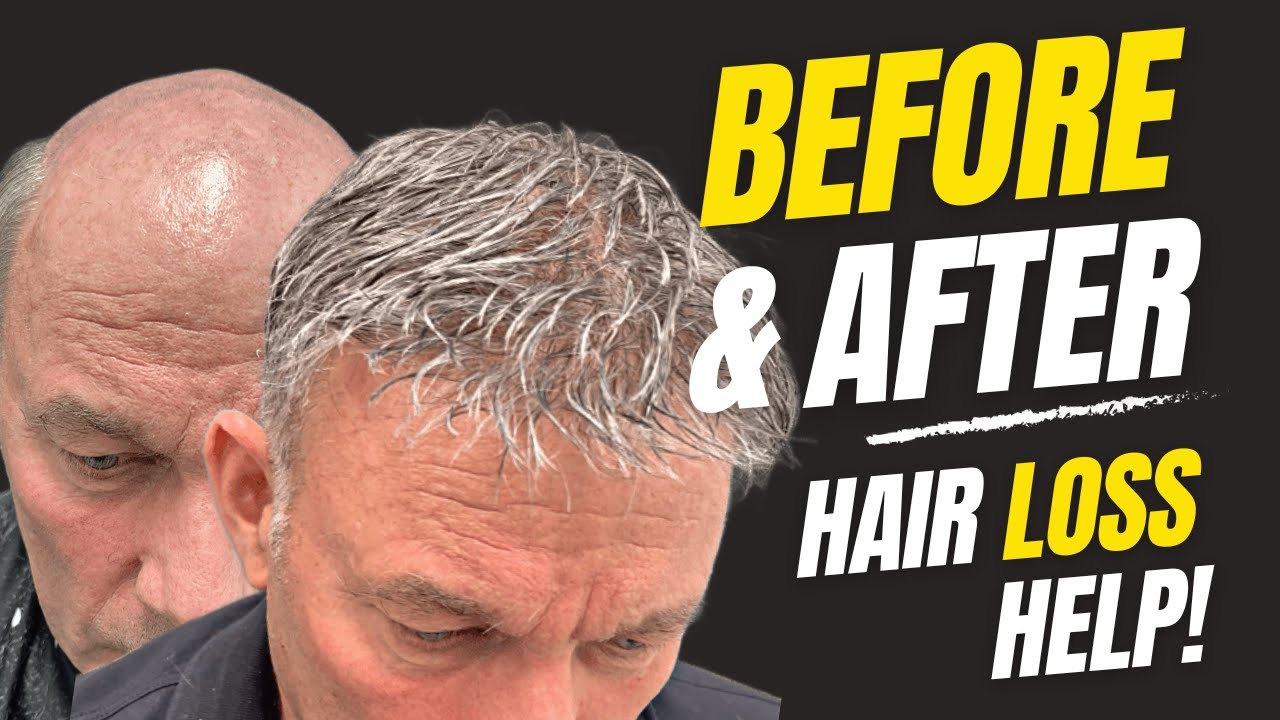 BEFORE & AFTER! HAIR SYSTEM! FITTING DAY!