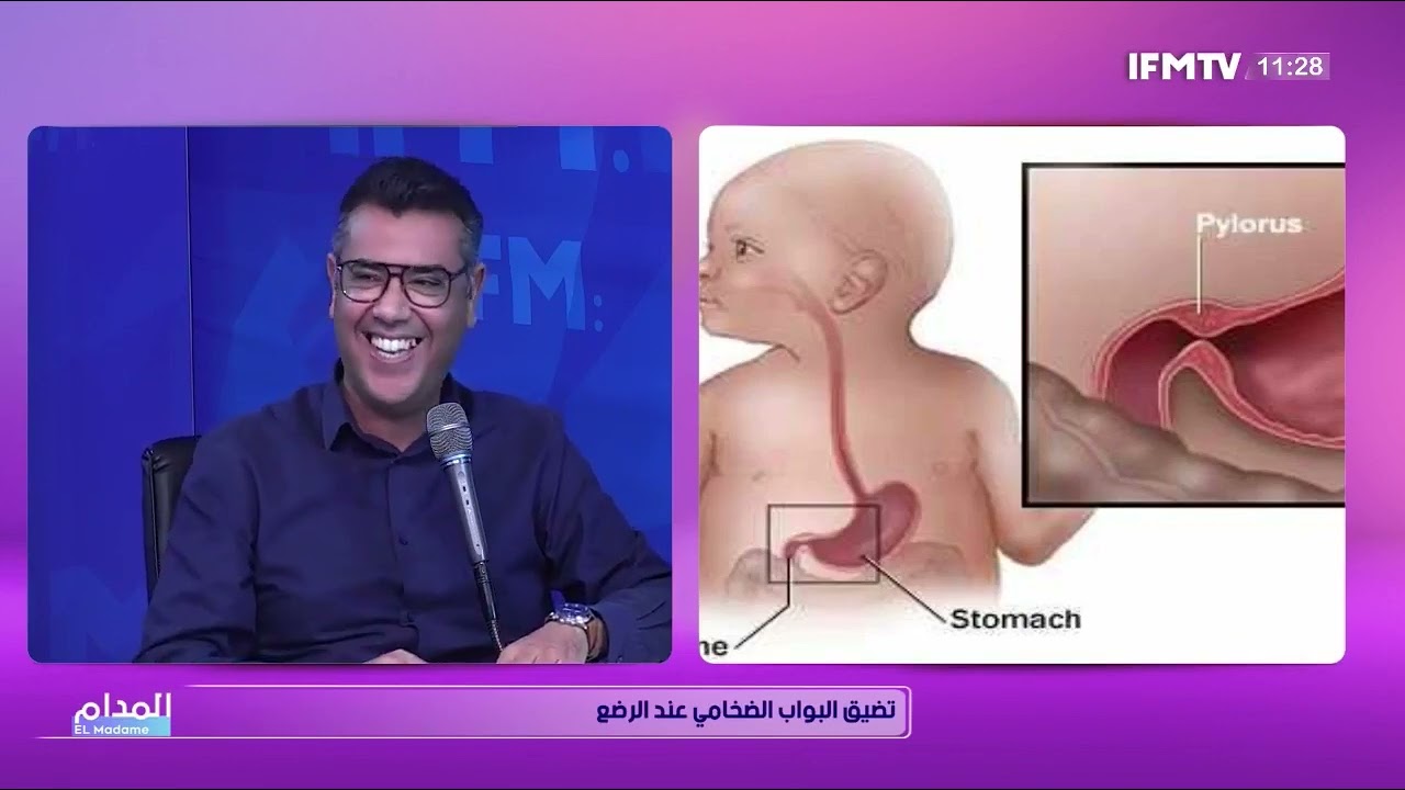 Dr Meher LABIDI  - مرض تضيق البواب الضخامي الي يصيب الرضع شنوة هو ؟