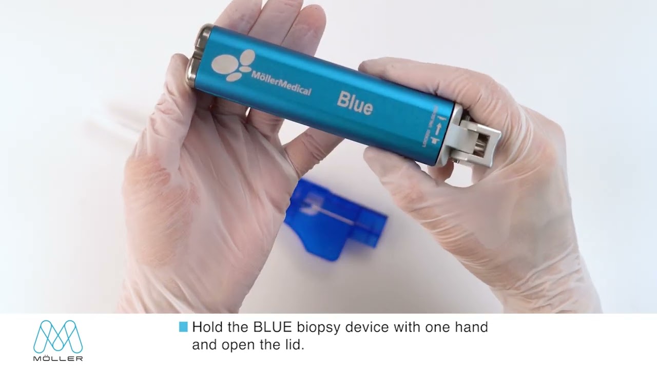 Inserting a DNG 1020 or full sCore needle to the BLUE Biopsy device