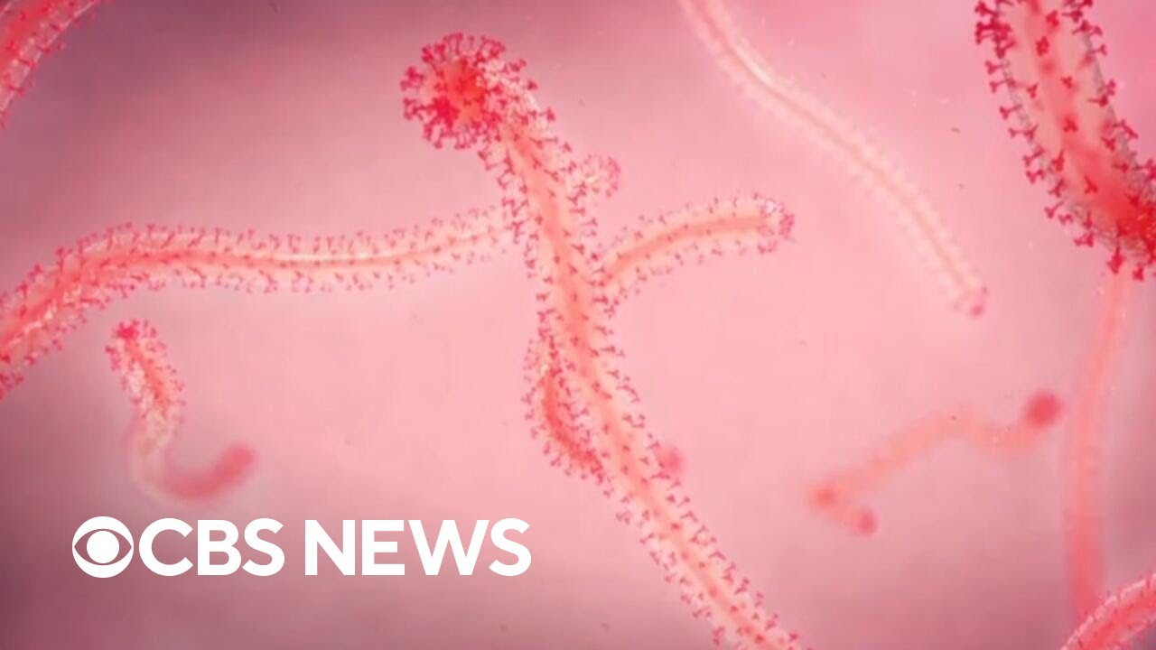 How health officials are responding to Congo Ebola outbreak