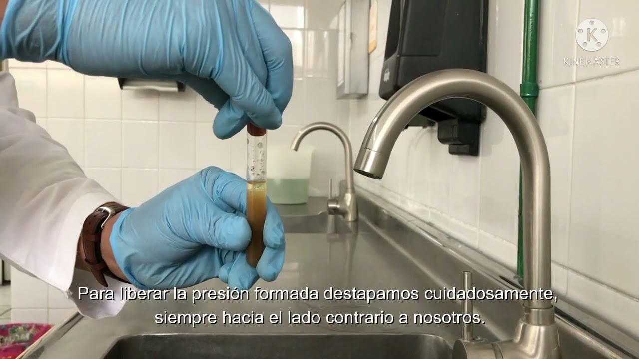 Técnica Coproparasitologico de concentración - MÉTODO DE RITCHIE