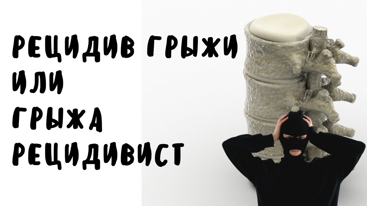 Рецидив грыжи или грыжа рецидивист