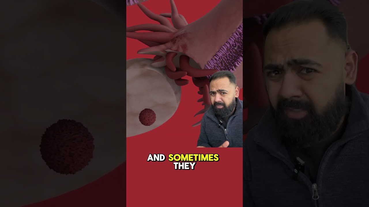Doctor Explains Ectopic Pregnancy Glitch!