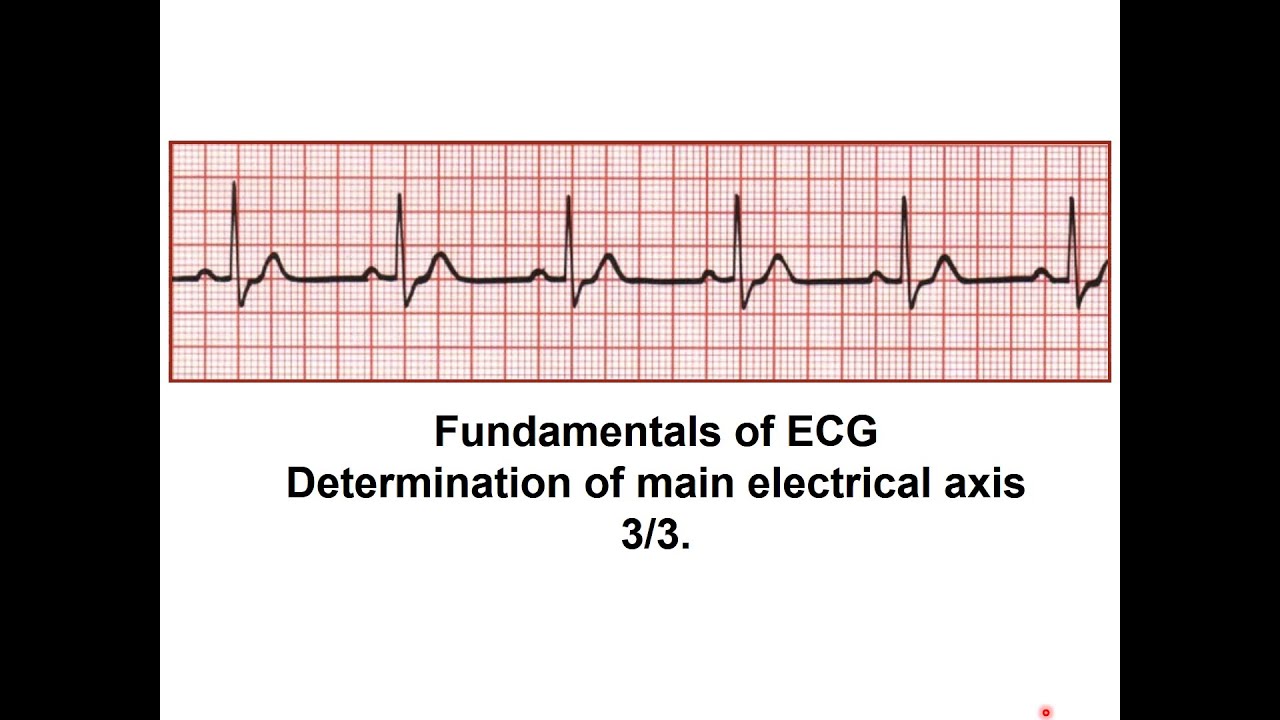 Fundamentals of ECG  - Determination of main electrical axis 3/3