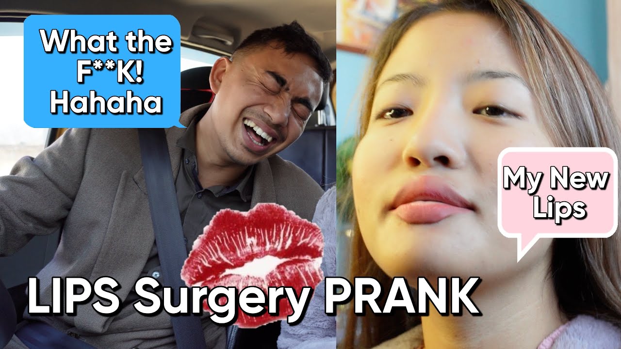 Lips Surgery PRANK on my Husband 😂 / Too Funny 😂😂😂😂