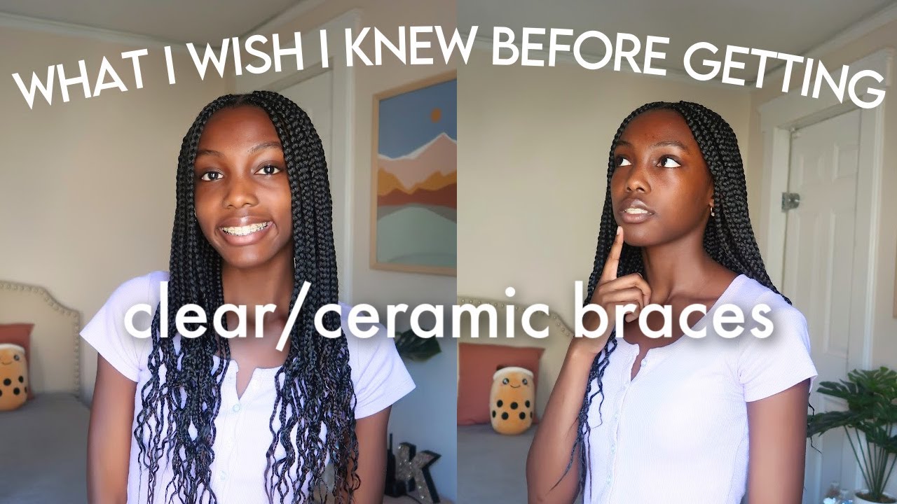 what i wish i knew before getting clear/ceramic braces