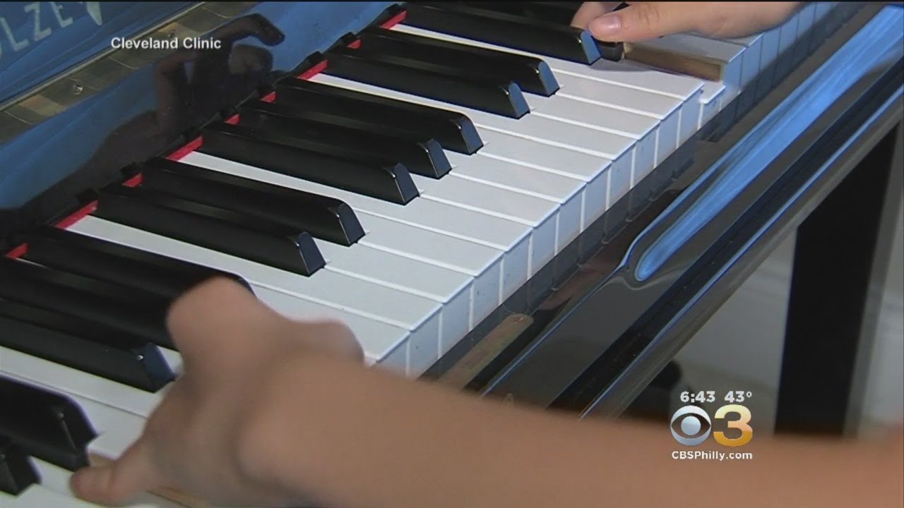 Unique Hand Surgery Allowed Young Girl To Blossom Into Accomplished Pianist