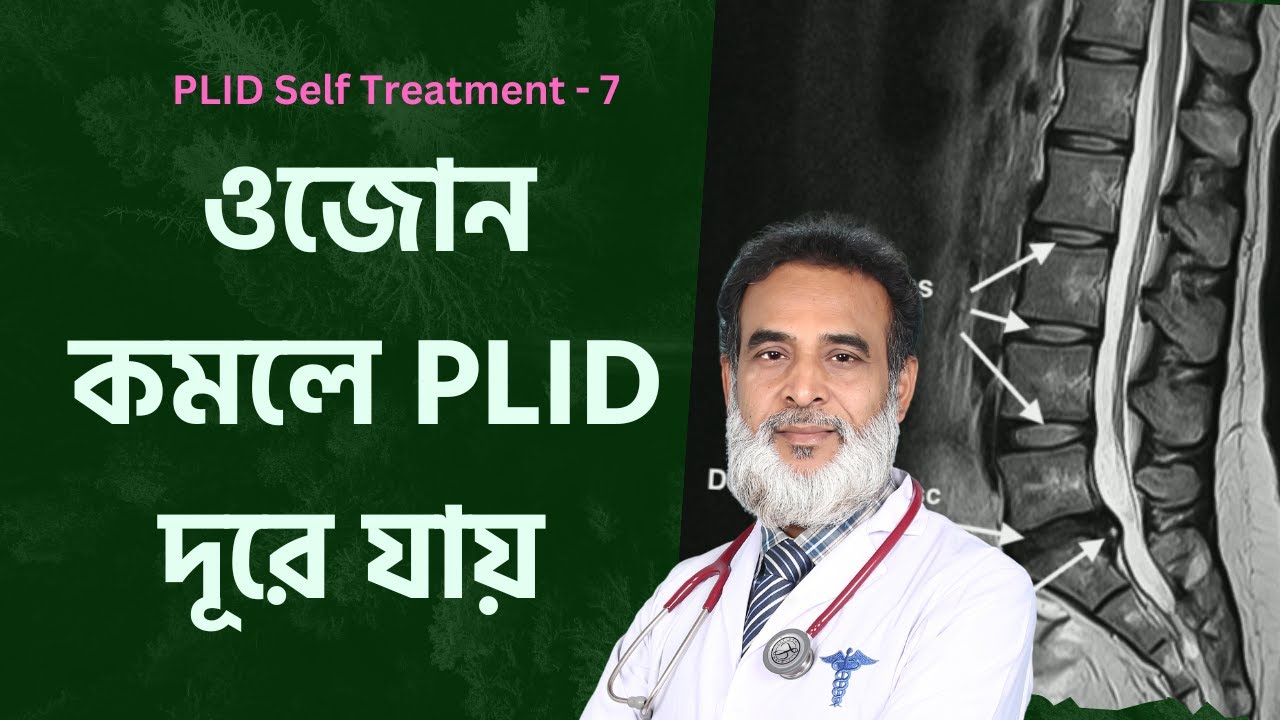 নিজে নিজে PLID চিকিৎসা-৭  | ওজন কমলে PLID দূরে যায় | Weight Loss For PLID | Doctor Shah Alam