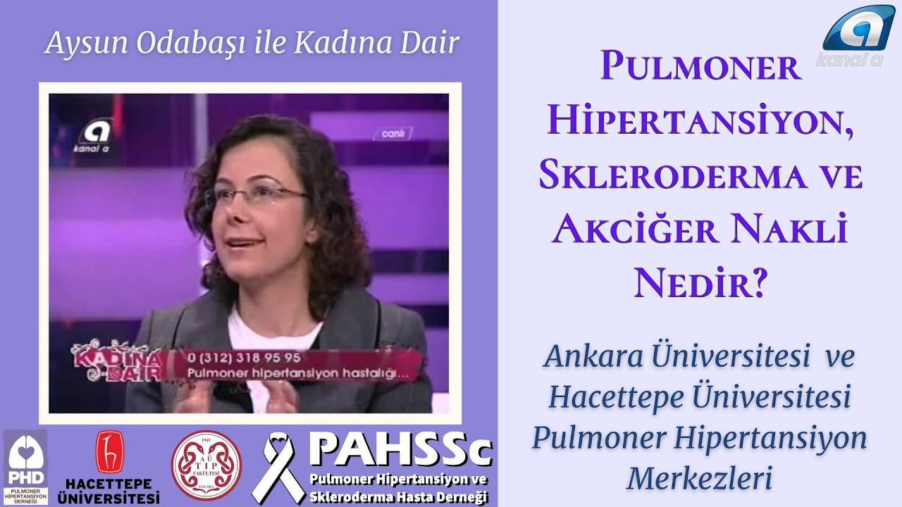 PHD - Kanal A - Kadına Dair - Skleroderma, Sistemik Skleroz ve Pulmoner Arteriyel Hipertansiyon