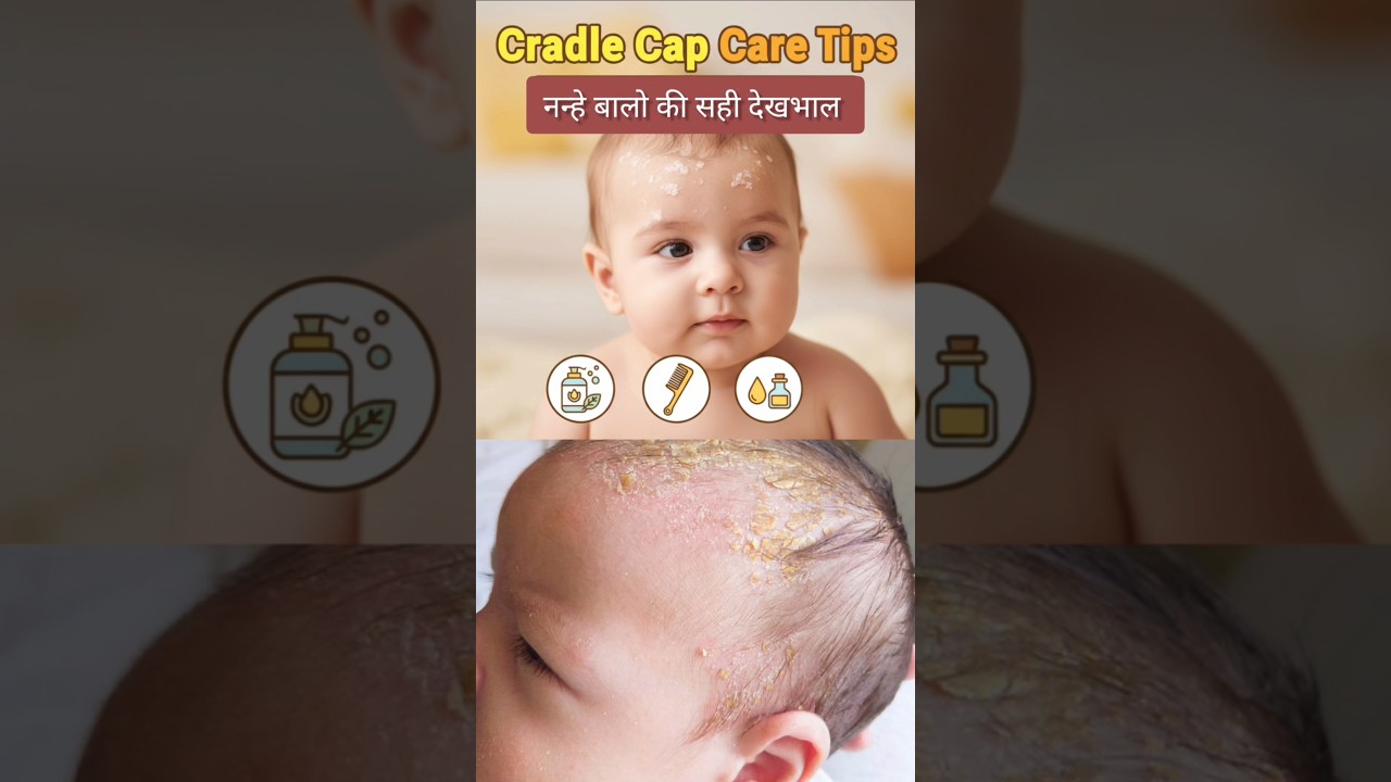 Cradle Cap care for newborns|   Tried and tested ✅️ #newmom #newborn