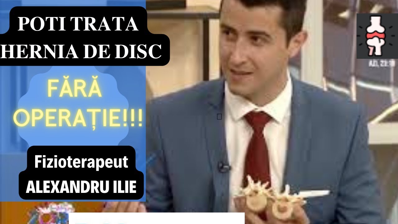 🔥𝐏𝐎𝐓𝐈 𝐓𝐑𝐀𝐓𝐀 𝐇𝐄𝐑𝐍𝐈𝐀 𝐃𝐄 𝐃𝐈𝐒𝐂 𝐅𝐀𝐑𝐀 𝐎𝐏𝐄𝐑𝐀𝐓𝐈𝐄❗️❗️ Află cum... Fizioterapeut 𝐀𝐋𝐄𝐗𝐀𝐍𝐃𝐑𝐔 𝐈𝐋𝐈𝐄, RestartiX