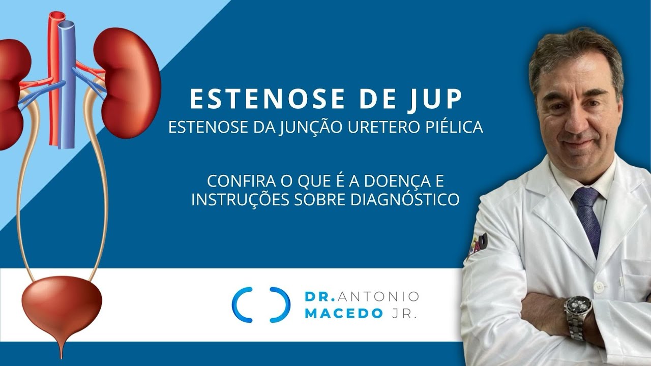 Estenose de Jup - A Doença e o Diagnóstico - Dr. Macedo