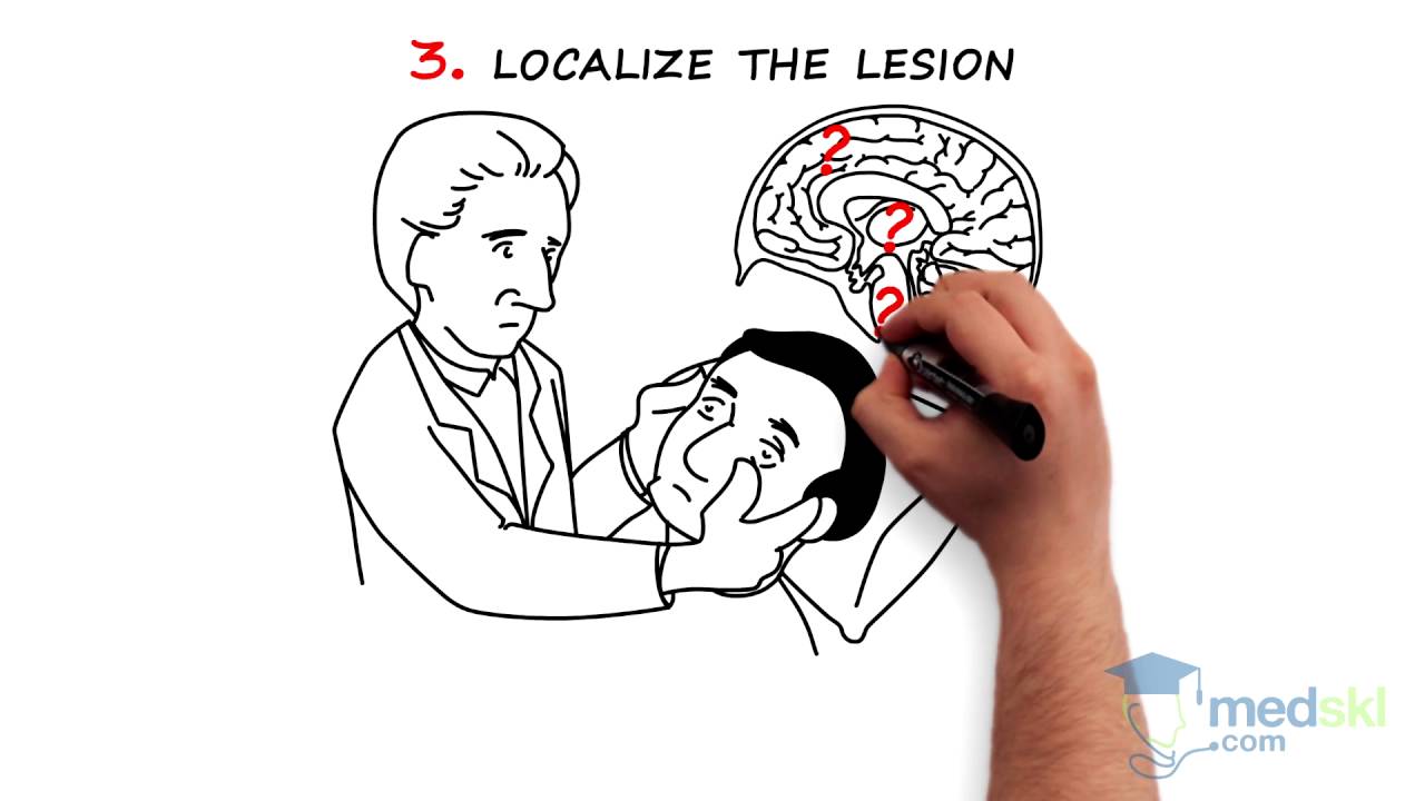 Neurology – Coma: By Michel Shamy M.D.
