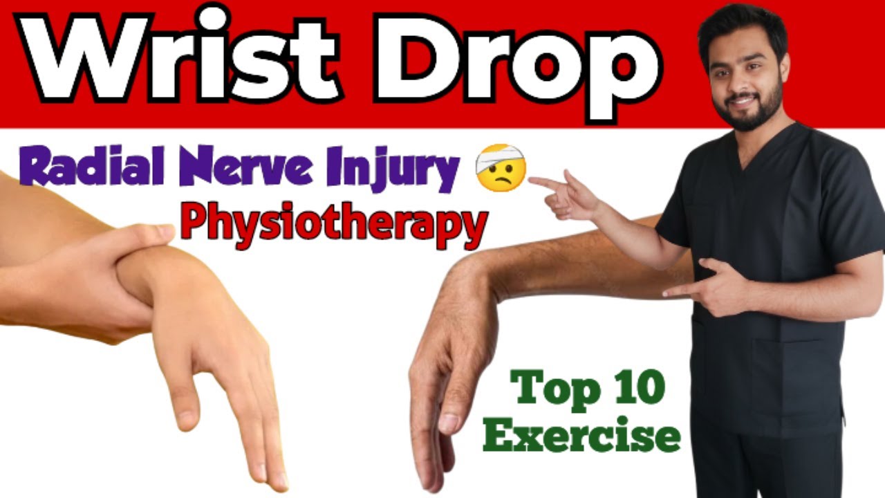 “Wrist Drop / Radial Nerve Palsy Physiotherapy Exercises | Pain Relief & Hand Strength | Dr  Zaman