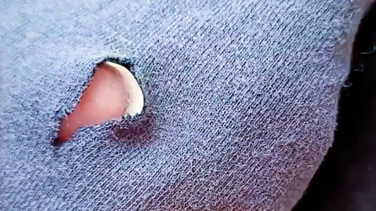Simple and Practical Invisible Stitch Method for Repairing Holes in Clothes