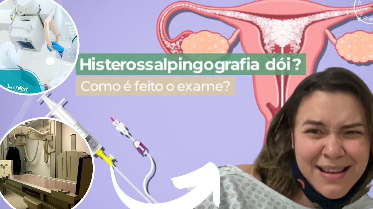 HISTEROSSALPINGOGRAFIA: O QUE VOCÊ PRECISA SABE ANTES DO EXAME?