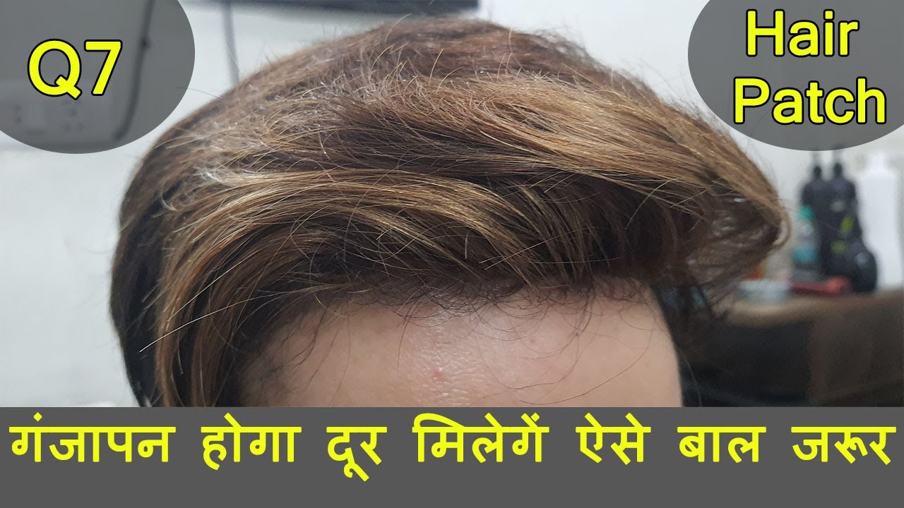 Q7 Hair Patch | Super Filament Hair Patch Piece with Glue & Tape Both Options by PHC CALL 9899746489