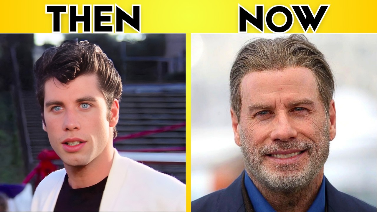 50 Famous Stars Who Are Now Totally Unrecognizable (Then & Now)