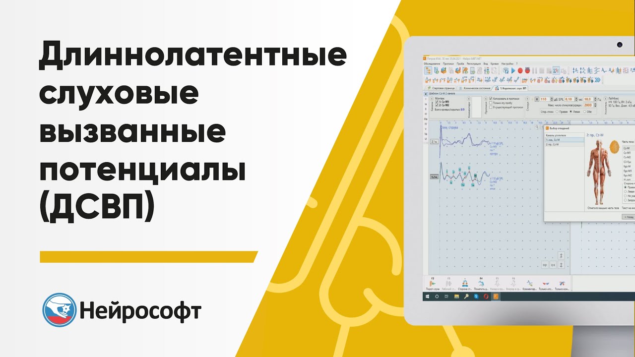 Длиннолатентные слуховые вызванные потенциалы (ДСВП)