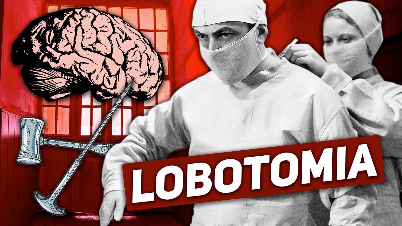 LOBOTOMIA: HISTORIAN JÄRKYTTÄVIN HOITOMUOTO