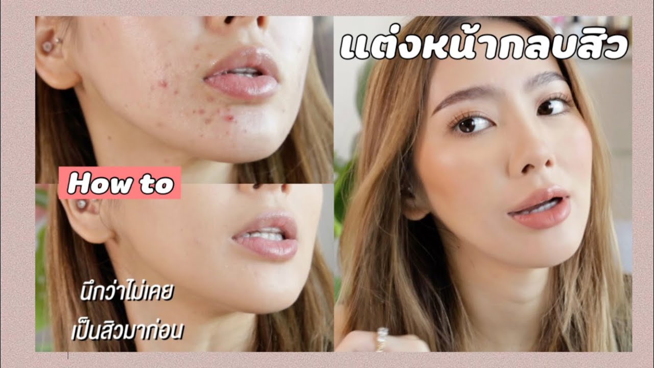 ในวันผิวพัง! How to แต่งหน้ากลบสิว | Ruk.sherene