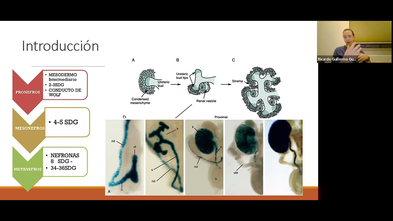 SESION - Conceptos Esenciales de la Enfermedad Renal en el Neonato.