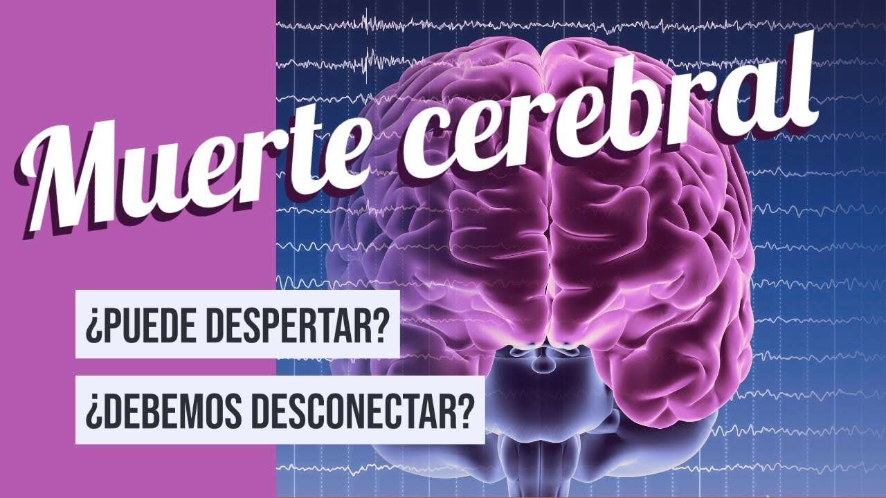 Muerte cerebral ¿Se debe desconectar?