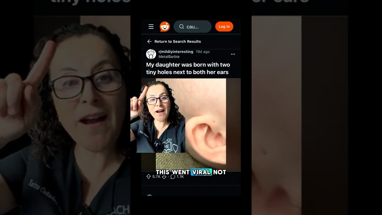 Ушные ямки: почему и что они могут означать #ушныеямки #лордоктор