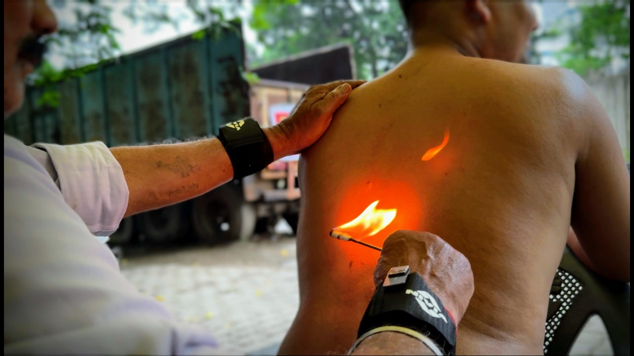 🔥 Narsha Baba’s Extreme Fire Back Massage | Powerful Heat Therapy ASMR for Pain Relief & Relaxation