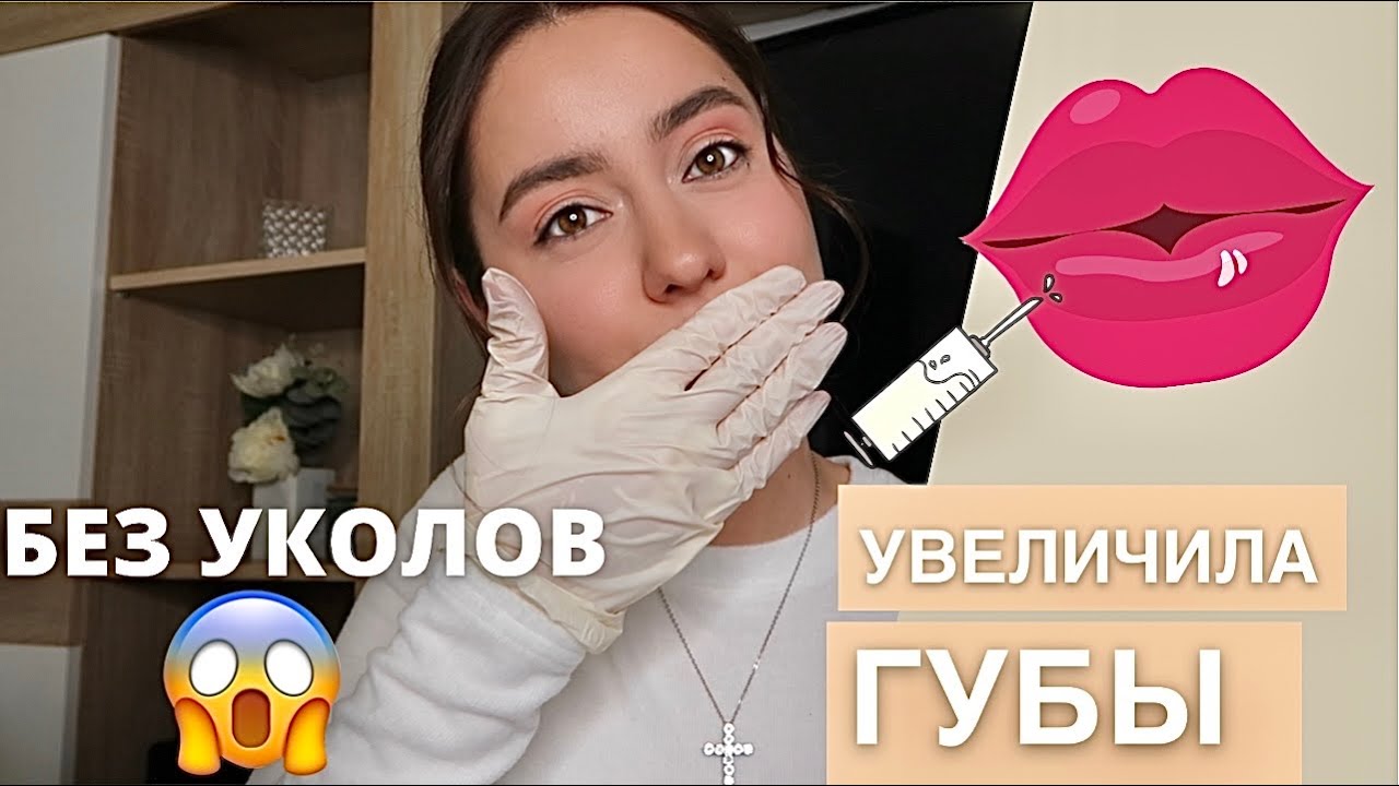 УВЕЛИЧИЛА САМА СЕБЕ  ГУБЫ💉😱 ГИАЛУРОН ПЕН | БЕЗЫГОЛЬНОЕ УВЕЛИЧЕНИЕ ГУБ