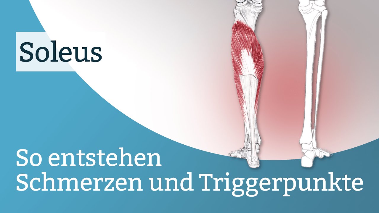 Soleus Schmerzen, Triggerpunkte und deren Aktivierung