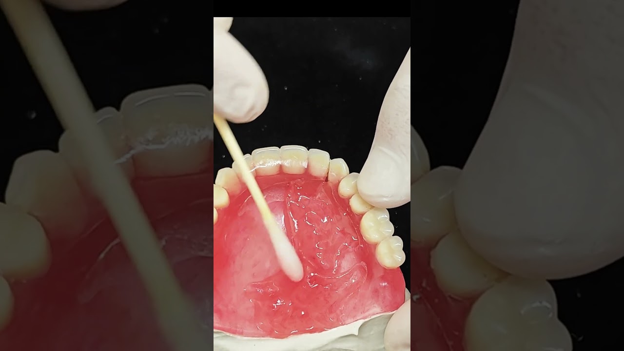 The Restoration Artisan #dentist #satisfying