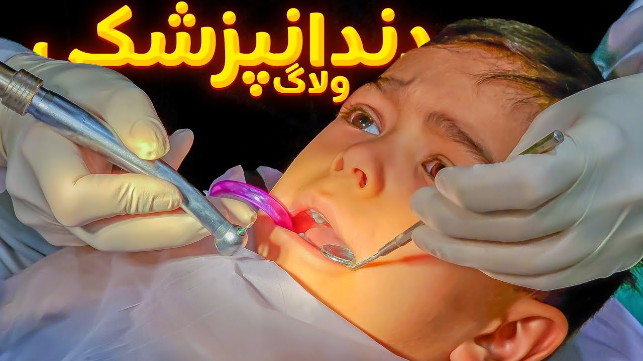 امیرعلی دندونش رو کشید🫣 | ولاگ دندانپزشکی