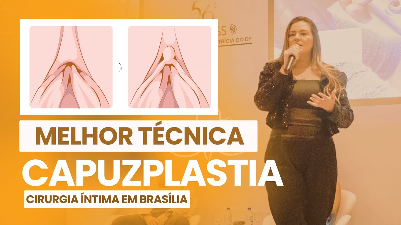 MELHOR TÉCNICA DE CAPUZPLASTIA - Dra. Thalia Maia - Ginecologista - Brasília