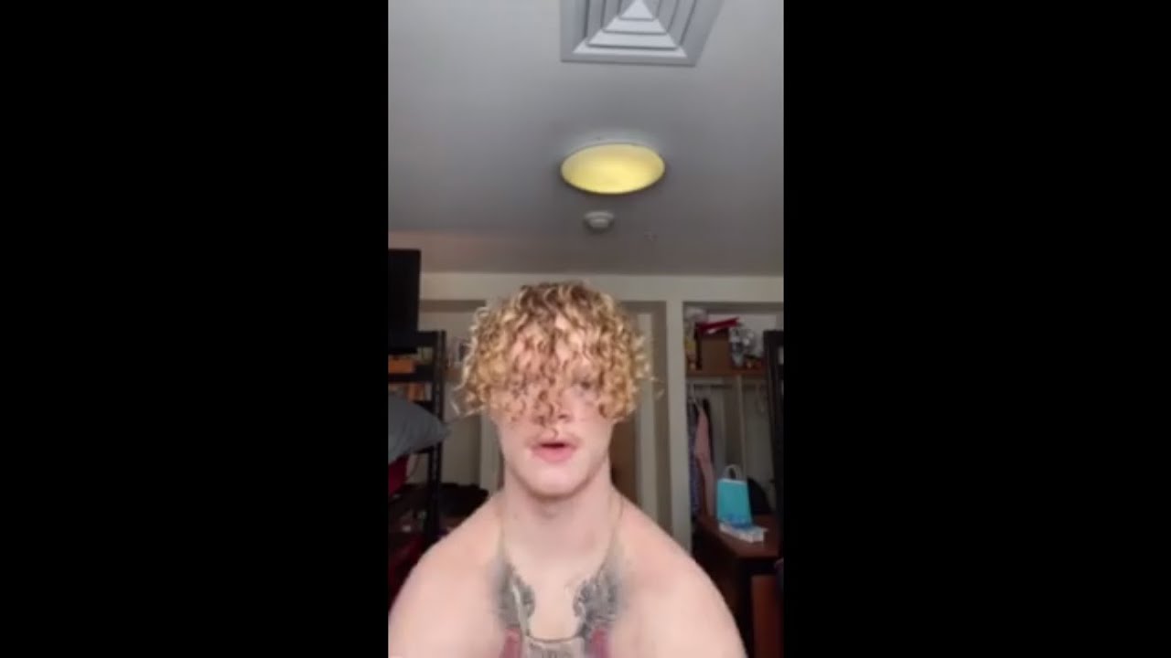 Guy Born Without Collar Bones Folding Both Shoulders