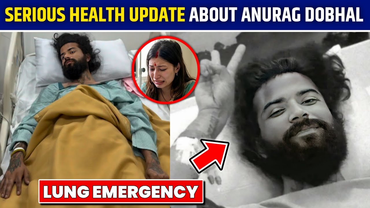 Anurag Dobhal Health Update After Incident | Manager Statement